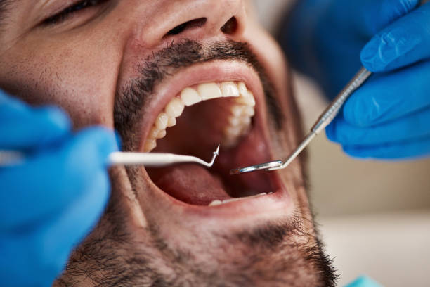 Best Emergency Treatment for Oral Infections in South Valley, NM
